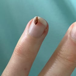 Adult-Bed-bug-on-finger