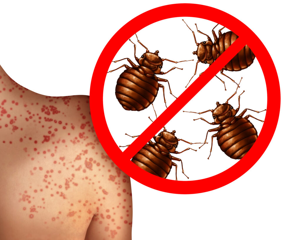 Early Signs Of Bed Bug Infestation Heat Rx